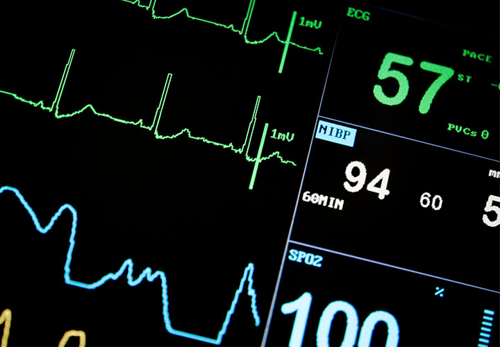 Close up photo of a heart rate monitor